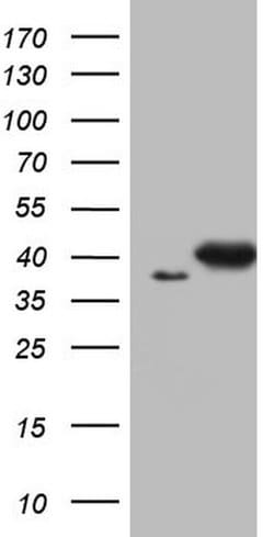 ERCC1 Mouse anti-Human, Clone: OTI2H1, lyophilized, TrueMAB 100 &mu;g;