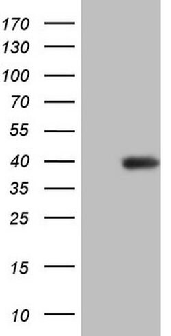 ERCC1 Monoclonal Antibody (OTI2B4), TrueMAB , OriGene 100 &mu;L; Unconjugated:Antibodies,