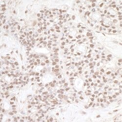 ERCC3 Rabbit anti-Human, Polyclonal, Bethyl Laboratories 100 &mu;L; Unconjugated:Antibodies,