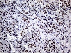 ERCC3 Mouse anti-Human, Clone: OTI6H8, lyophilized, TrueMAB 100 &mu;g;