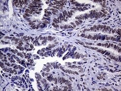 ERCC3 Mouse anti-Human, Clone: OTI6H8, lyophilized, TrueMAB 100 &mu;g;
