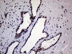 ERCC3 Mouse anti-Human, Clone: OTI6H8, lyophilized, TrueMAB 100 &mu;g;