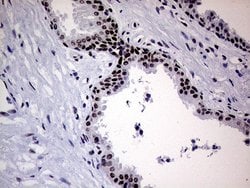 ERCC3 Mouse anti-Human, Clone: OTI6H8, lyophilized, TrueMAB 100 &mu;g;