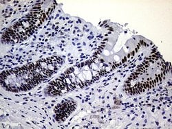ERCC3 Mouse anti-Human, Clone: OTI6H8, lyophilized, TrueMAB 100 &mu;g;