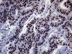 ERCC3 Mouse anti-Human, Clone: OTI6H8, lyophilized, TrueMAB 100 &mu;g;
