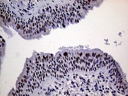 ERCC3 Mouse anti-Human, Clone: OTI6H8, lyophilized, TrueMAB 100 &mu;g;