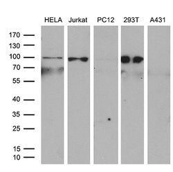 ERCC3 Mouse anti-Human, Clone: OTI6H8, lyophilized, TrueMAB 100 &mu;g;