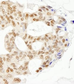 ERCC5/XPG Rabbit anti-Human, Polyclonal, Bethyl Laboratories 100 &mu;l;