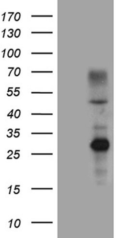 ERCC8 Mouse anti-Human, Clone: OTI5C9, lyophilized, TrueMAB 100 &mu;g;