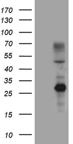 ERCC8 Monoclonal Antibody (OTI5C9), TrueMAB , OriGene 100 &mu;L; Unconjugated:Antibodies,