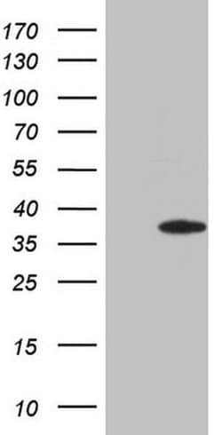 ERCC8 Monoclonal Antibody (OTI9B11), TrueMAB , OriGene 30 &mu;L; Unconjugated:Antibodies,