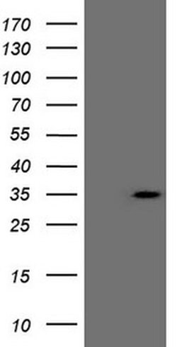 ERCC8 Monoclonal Antibody (OTI1G2), TrueMAB , OriGene 100 &mu;L | Buy Online | OriGene | Fisher Scientific