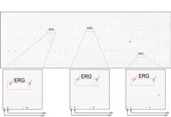 ERG Mouse anti-Human, Clone: UMAB76, liquid, UltraMAB 30 &mu;L | Buy Online | Origene Technologies | Fisher Scientific