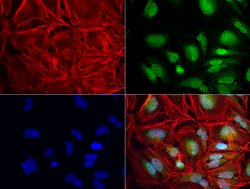 ERG Mouse anti-Human, Clone: UMAB76, liquid, UltraMAB 30 &mu;L | Buy Online | Origene Technologies | Fisher Scientific