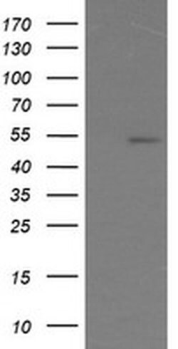 ERG Monoclonal Antibody (OTI5F12), TrueMAB , OriGene 30 &mu;L; Unconjugated:Antibodies,