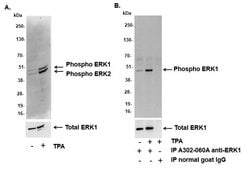 Phospho-ERK1/2 (Thr202,Tyr204, Thr185,Tyr187) Polyclonal Antibody, Bethyl Laboratories 20 &mu;L | Buy Online | Bethyl Laboratories, Inc | Fisher Scientific