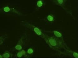 ERK3 Mouse anti-Human, Clone: OTI5E1, lyophilized, TrueMAB 100 &mu;g; Unconjugated:Antibodies,