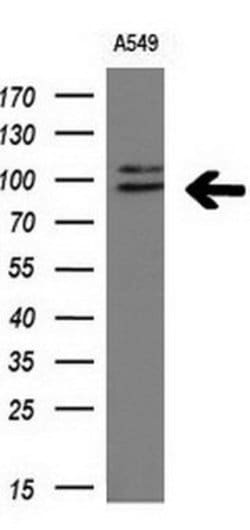 ERK3 Mouse anti-Human, Clone: OTI5E1, lyophilized, TrueMAB 100 &mu;g; Unconjugated:Antibodies,