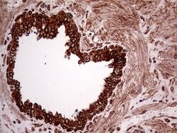 ERLIN1 Mouse anti-Human, Clone: OTI4B1, lyophilized, TrueMAB 100 &mu;g;