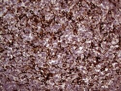 ERLIN1 Mouse anti-Human, Clone: OTI4B1, lyophilized, TrueMAB 100 &mu;g;