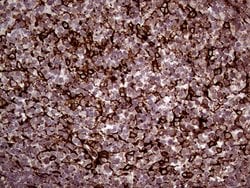 ERLIN1 Monoclonal Antibody (OTI4B1), TrueMAB , OriGene:Antibodies:Primary