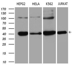 ERLIN1 Mouse anti-Human, Clone: OTI4B1, lyophilized, TrueMAB 100 &mu;g;