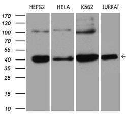 ERLIN1 Monoclonal Antibody (OTI4B1), TrueMAB , OriGene 100 &mu;L; Unconjugated:Antibodies,