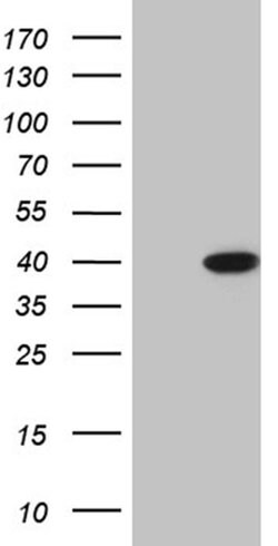 ERLIN1 Monoclonal Antibody (OTI4C11), TrueMAB , OriGene:Antibodies:Primary