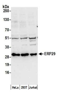 ERP29 Polyclonal Antibody, Bethyl Laboratories 20 &mu;L; Unconjugated:Antibodies,