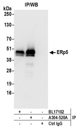 ERp5 Rabbit anti-Human, Polyclonal, Bethyl Laboratories 100 &mu;L; Unconjugated:Antibodies,