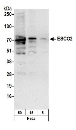 ESCO2 Polyclonal Antibody, Bethyl Laboratories 20 &mu;L; Unconjugated:Antibodies,