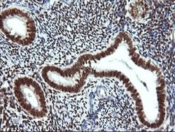 ESR1 Monoclonal Antibody (OTI2E10), TrueMAB , OriGene 100 &mu;L; Unconjugated:Antibodies,