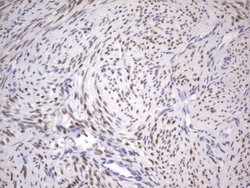 ESR1 Monoclonal Antibody (OTI2D3), TrueMAB , OriGene 30 &mu;L; Unconjugated:Antibodies,