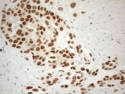 ESR1 Monoclonal Antibody (OTI2D3), TrueMAB , OriGene 30 &mu;L; Unconjugated:Antibodies,
