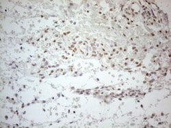 ESR1 Monoclonal Antibody (OTI8E9), TrueMAB , OriGene:Antibodies:Primary