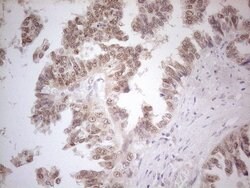 ESR1 Monoclonal Antibody (OTI8E9), TrueMAB , OriGene 100 &mu;L; Unconjugated:Antibodies,
