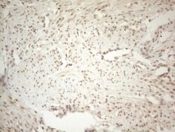 ESR1 Monoclonal Antibody (OTI8E9), TrueMAB , OriGene 100 &mu;L; Unconjugated:Antibodies,