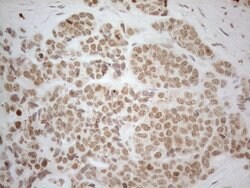 ESR1 Monoclonal Antibody (OTI8E9), TrueMAB , OriGene 100 &mu;L; Unconjugated:Antibodies,