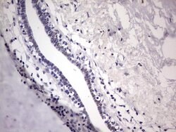 ESR1 Monoclonal Antibody (OTI8E9), TrueMAB , OriGene 100 &mu;L; Unconjugated:Antibodies,