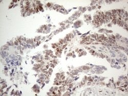 ESR1 Monoclonal Antibody (OTI5E11), TrueMAB , OriGene 30 &mu;L; Unconjugated:Antibodies,