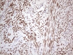ESR1 Monoclonal Antibody (OTI5E11), TrueMAB , OriGene 30 &mu;L; Unconjugated:Antibodies,