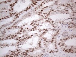 ESR1 Monoclonal Antibody (OTI5E11), TrueMAB , OriGene 30 &mu;L; Unconjugated:Antibodies,