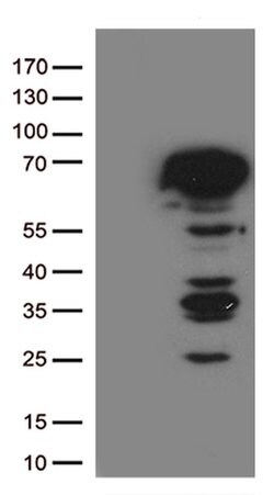 ESR1 Monoclonal Antibody (OTI2E10), TrueMAB , OriGene 100 &mu;L; Unconjugated:Antibodies,