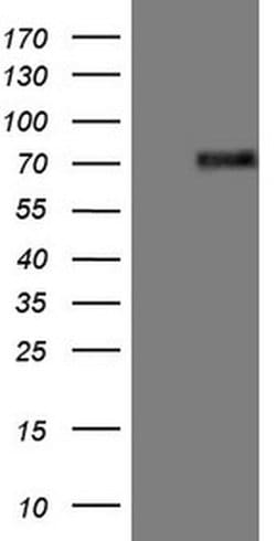 ESR1 Monoclonal Antibody (OTI5E11), TrueMAB , OriGene 30 &mu;L; Unconjugated:Antibodies,