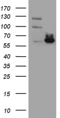 ESR2 Mouse anti-Human, Clone: OTI2E12, lyophilized, TrueMAB 100 &mu;g | Buy Online | Origene Technologies | Fisher Scientific