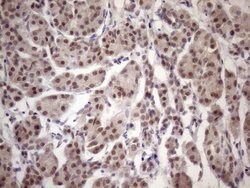 ESRRA Monoclonal Antibody (OTI2C12), TrueMAB , OriGene 30 &mu;L; Unconjugated:Antibodies,