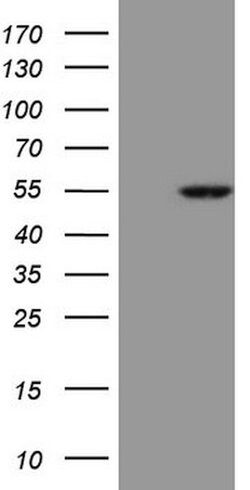 ESRRA Mouse anti-Human, Clone: OTI3G10, lyophilized, TrueMAB 100 &mu;g;