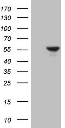 ESRRA Mouse anti-Human, Clone: OTI2G5, lyophilized, TrueMAB 100 &mu;g;
