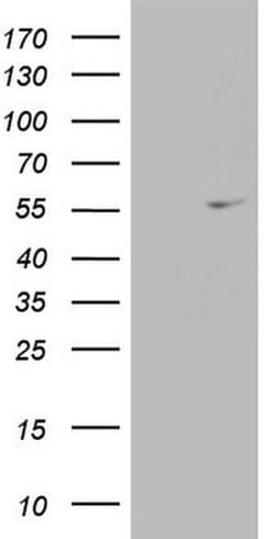 ESRRA Monoclonal Antibody (OTI2H9), TrueMAB , OriGene 100 &mu;L; Unconjugated:Antibodies,