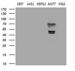 ESRRA Mouse anti-Human, Clone: OTI3G3, lyophilized, TrueMAB 100 &mu;g;